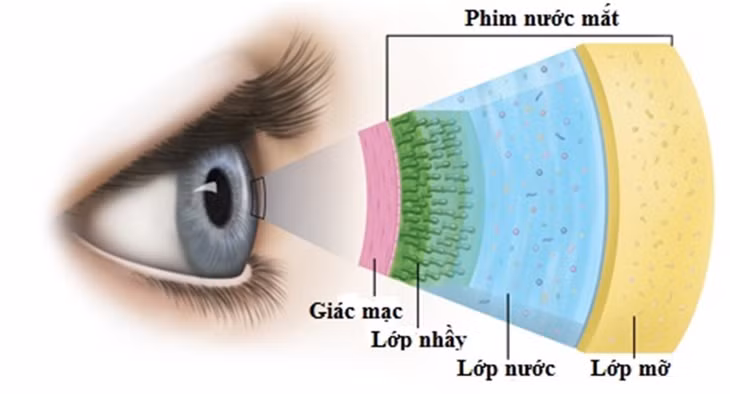 Khô mắt do nhiều nguyên nhân và cần điều trị sớm.
