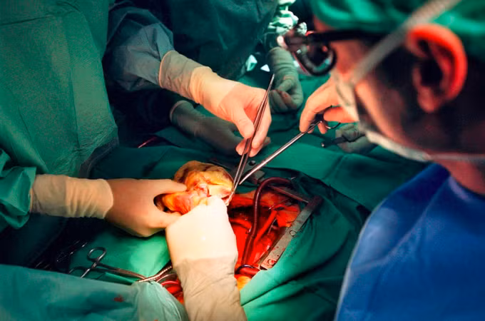 Bác sĩ thực hiện ca phẫu thuật ghép tim tại bệnh viện Inselspital ở Bern, Thụy Sĩ. Ảnh: Keystone