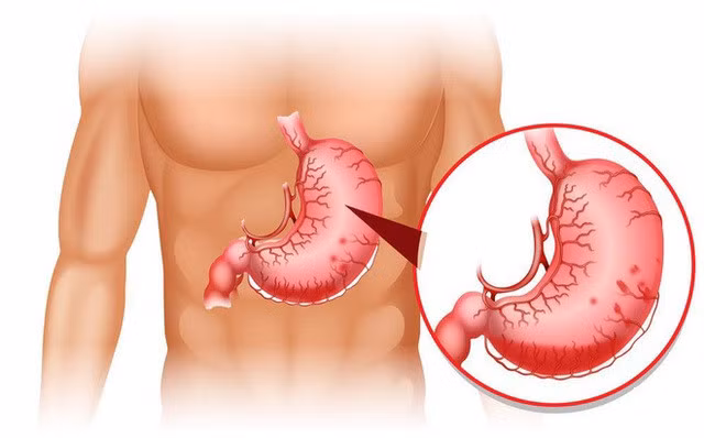 Khi có biểu hiện bất thường về đau dạ dày thì cần tới cơ sở y tế để được thăm khám và điều trị.