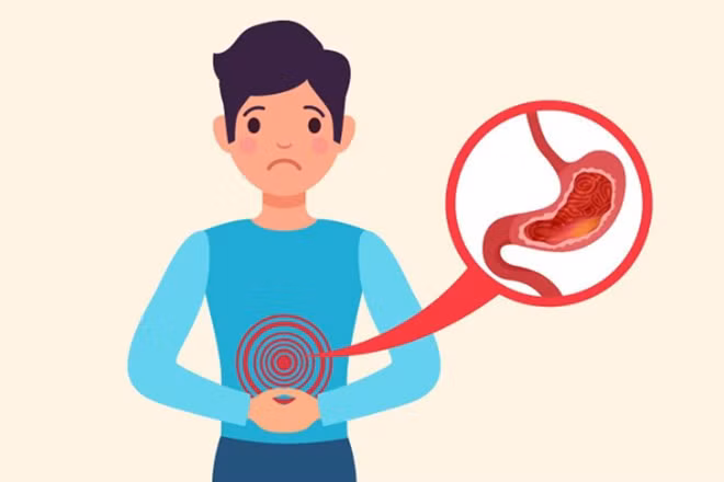 Sức khỏe đường tiêu hóa suy giảm do chế độ ăn nhiều thực phẩm chế biến. Đồ họa: Thiện Nhân
