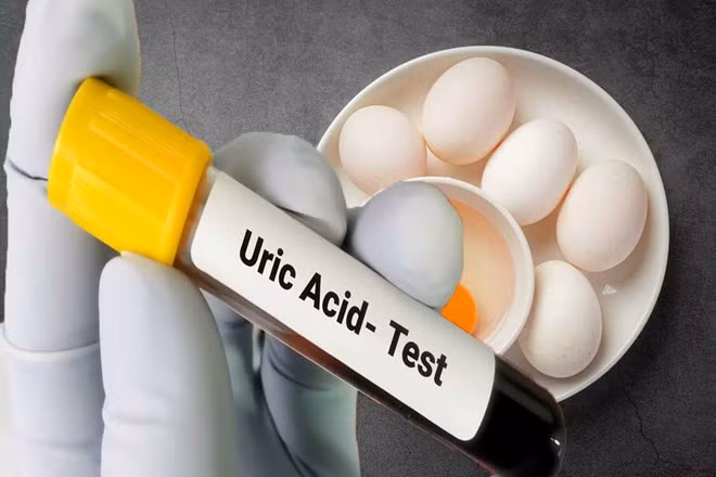 Người có axit uric cao có thể ăn trứng. Đồ hoạ: Hạ Mây