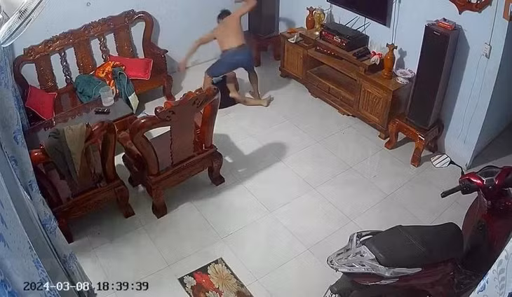Bé trai bị cha dượng bạo hành dã man gây bức xúc dư luận. (Ảnh: TTXVN phát)