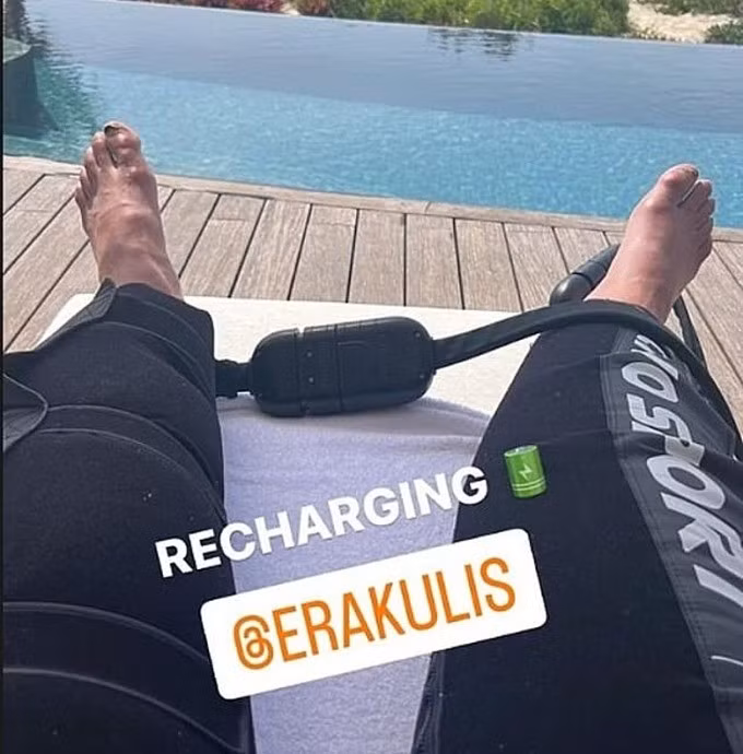 Đôi bàn chân sưng tấy của Ronaldo. Ảnh: Instagram / Cristiano Ronaldo