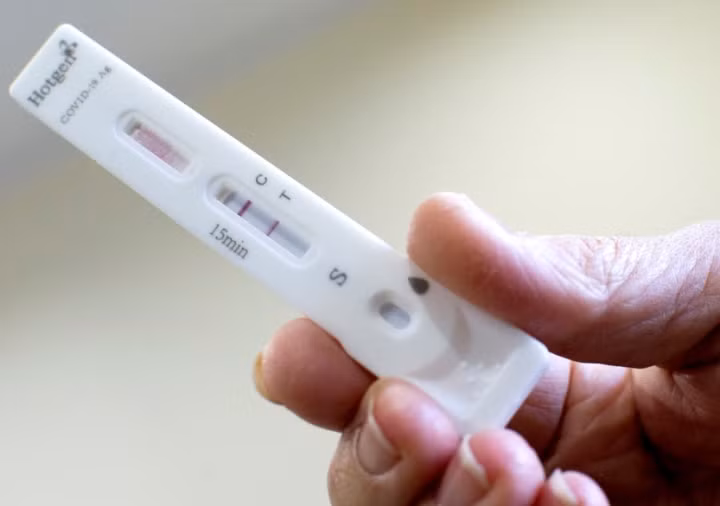 Vạch T bị mờ có thể là do tải lượng virus thấp hoặc độ nhạy của kit. (Ảnh: AP)