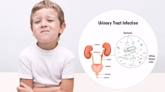 Nhiễm trùng tiểu là một bệnh lý khá thường gặp ở trẻ em.