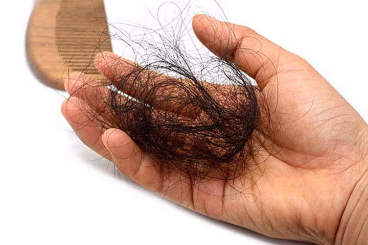 Tóc sẽ rụng nhiều vào mùa đông.