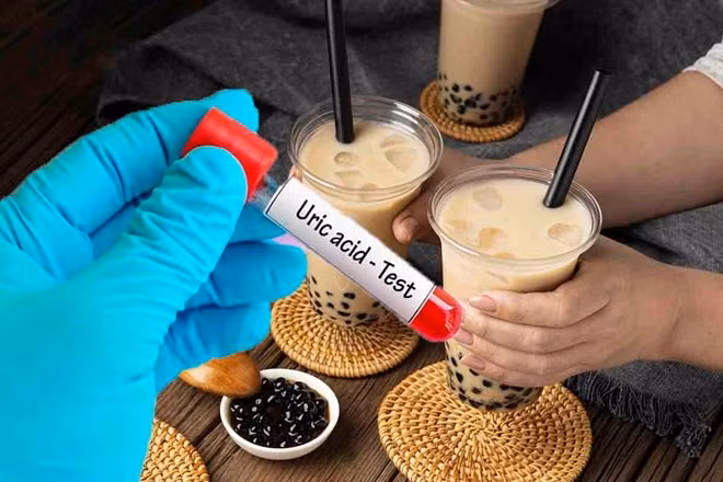 Người có axit uric cao không nên uống trà sữa. Đồ hoạ: Hạ Mây