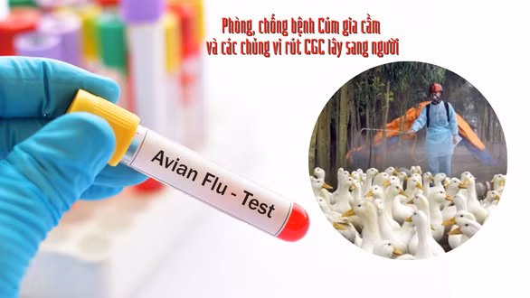 Nếu nghi ngờ mình mắc các loại virus cúm nguy hiểm như H5N1, H1N1, H7N9… hay có các triệu chứng cúm trở nặng cần đi khám ngay.