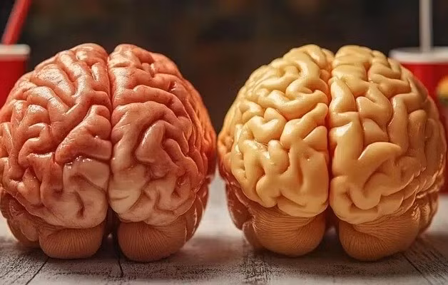 Các vấn đề do chất béo bão hòa gây ra liên quan đến trí nhớ và viêm não - Ảnh: NEUROSCIENCE NEWS