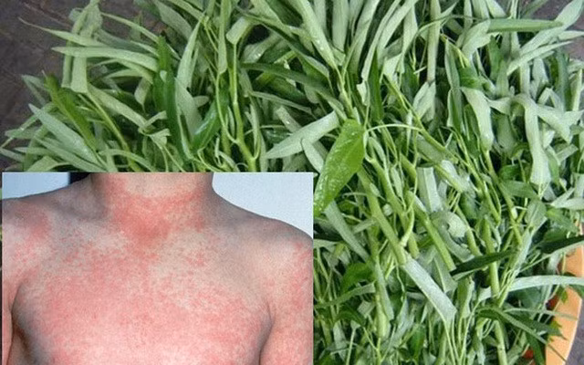 Rau muống nấu nước tắm giúp giảm ngứa do rôm sảy trong mùa hè.