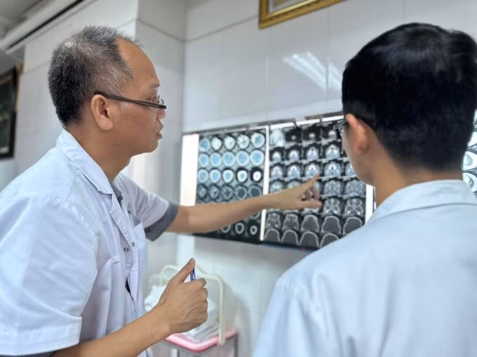 Các bác sĩ hội chẩn qua phim chụp sọ não, vùng hàm mặt cho bệnh nhi. Ảnh: Lê Nga