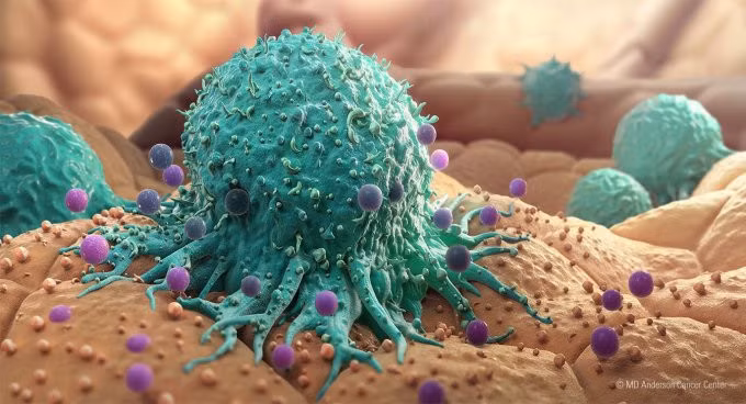 Mô phỏng tế bào ung thư đang lây lan các mô khỏe mạnh. Ảnh: MD Anderson Cancer Canter