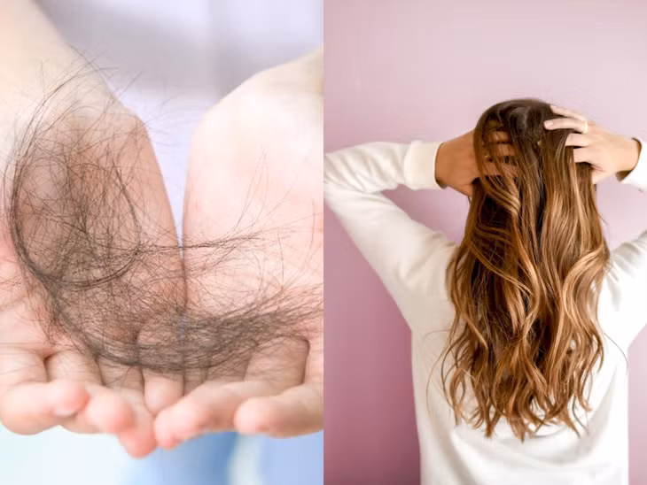 Rụng tóc là nỗi ám ảnh của phụ nữ. Ảnh: Minh Nhật.