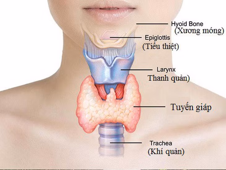 Bệnh tuyến giáp khó giảm cân. Ảnh: Bệnh viện Chợ Rẫy