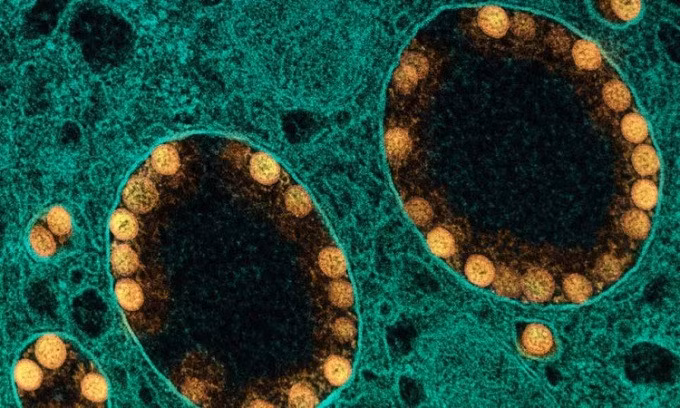Hạt virus nCoV màu vàng bên trong túi liên kết màng của tế bào biểu mô. Ảnh: NIH