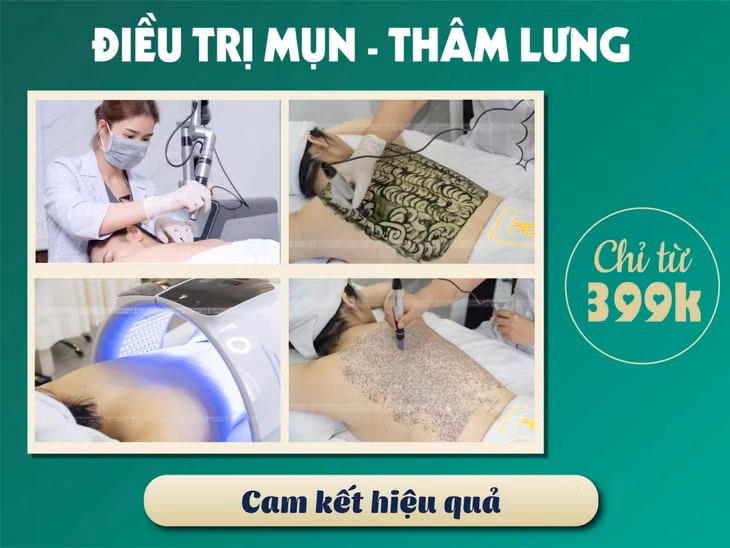 5 cách trị mụn lưng nam giới tại nhà hiệu quả ảnh 2