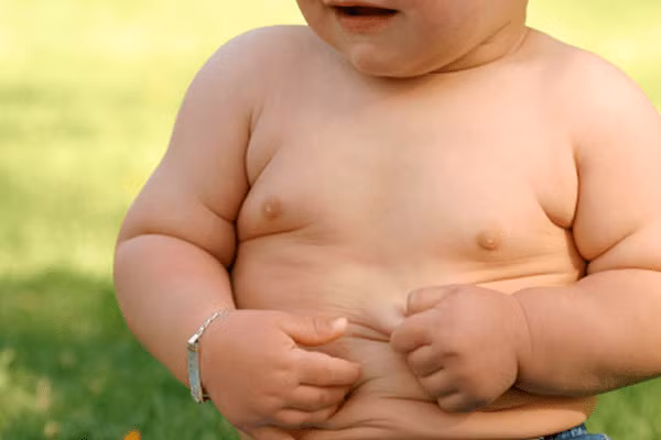 Có nhiều nguyên nhân gây tình trạng béo phì ở trẻ.
