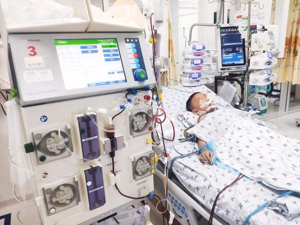 Bé trai 8 tuổi phải lọc máu vì Hội chứng viêm đa hệ thống liên quan hậu Covid-19. Ảnh: BVCC