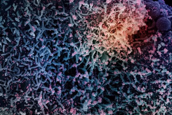 Virus SARS-CoV-2 xuất hiện tại mẫu mô não của 5 trong 6 tử thi. Ảnh: Viện Dị ứng và Bệnh truyền nhiễm Quốc gia Mỹ.