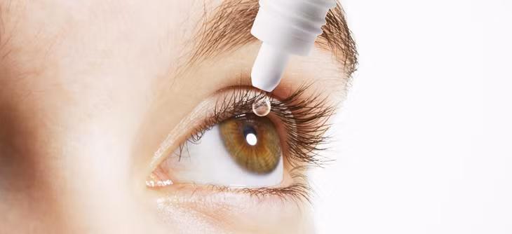 Việc giữ cho mí mắt, da và tóc sạch sẽ sẽ giúp kiểm soát các triệu chứng viêm bờ mi.