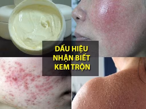 Có nhiều cách để phát hiện kem trộn chứa chất cấm
