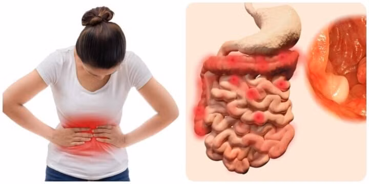 Giảm cân cũng có thể liên quan đến điều trị ung thư.