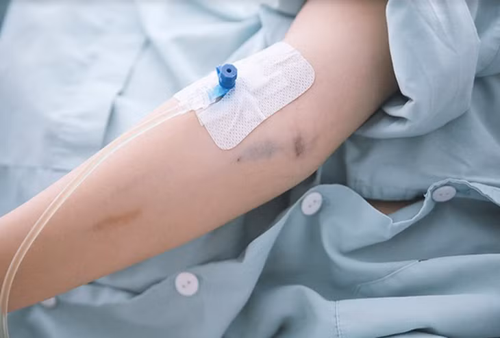 Truyền dịch tại nhà tiềm ẩn nhiều nguy cơ.