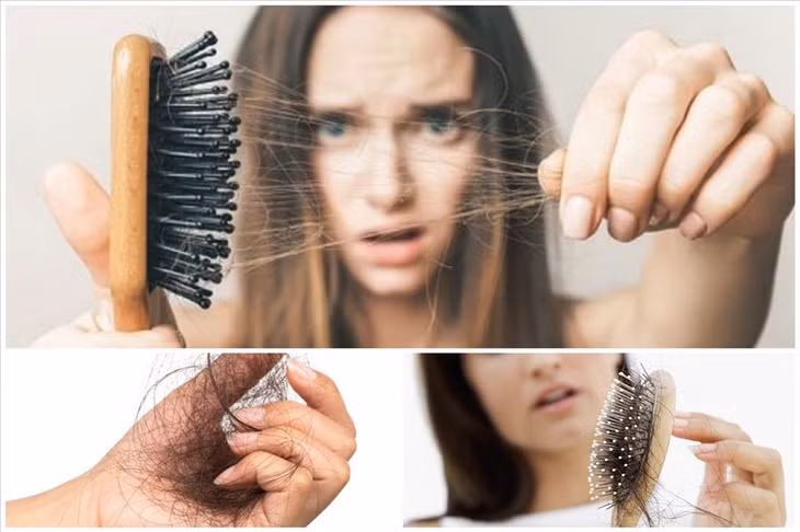 Một trong những nguyên nhân gây rụng tóc phổ biến nhất xoay quanh chế độ dinh dưỡng của bạn. Đồ hoạ: Minh Thư