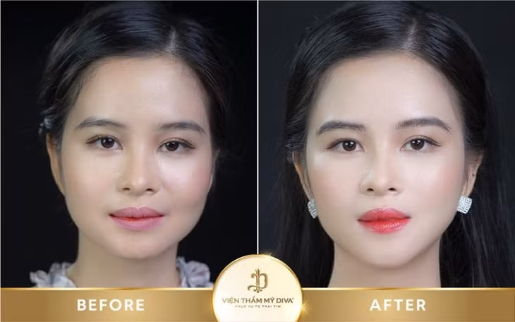 Thẩm mỹ viện DIVA - Thẩm mỹ viện uy tín TPHCM ảnh 3