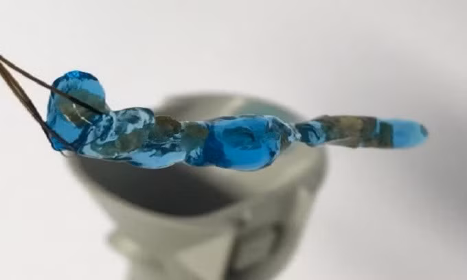 Khối hydrogel với những mẩu sỏi thận ở bên trong. Ảnh: Purenum GmbH