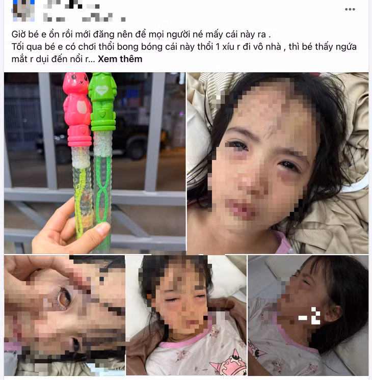 Bài viết của mẹ bé gái bị viêm mắt do đồ chơi bong bóng xà phòng - Ảnh chụp màn hình
