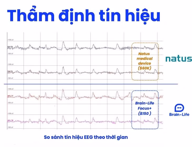 "Trong thử nghiệm các trạng thái Thư giãn, Nghỉ tự do và Tập trung, chúng tôi đo đồng thời trên cùng một người bằng thiết bị Brain-Life và so sánh với tín hiệu EEG từ máy Natus dùng trong chẩn đoán lâm sàng" - ThS.BS Bùi Diễm Khuê - Trường đại học Y Dược TP.HCM, Phó tổng thư ký Hội Y học Giấc ngủ Việt Nam