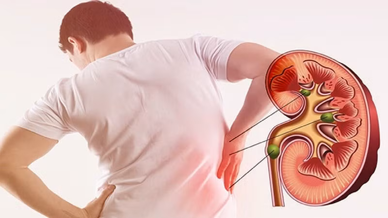 Người có tiền sử sỏi thận hoặc rối loạn chuyển hóa oxalat cần thận trọng khi dùng C sủi.
