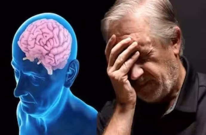 Bệnh Alzheimer. (Nguồn: thehealthsite)