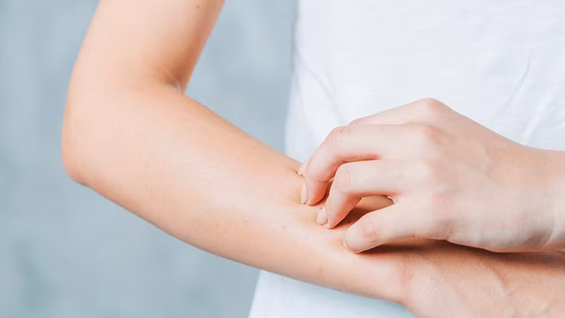 Dị ứng thời tiết gây ra cảm giác khó chịu cho người bệnh.