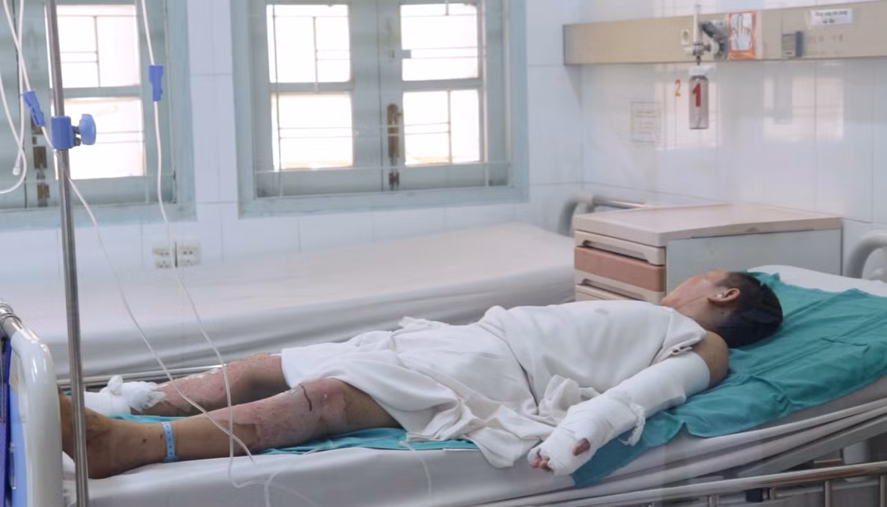 Bệnh viện Nhi đồng 2 tiếp nhận liên tiếp các trường hợp là học sinh bị chấn thương nặng do chơi pháo nổ tự chế.