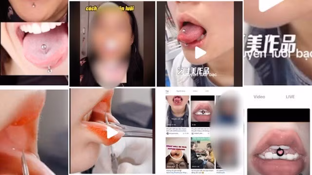 Xỏ khuyên được nhiều người trẻ yêu thích nhưng tiềm ẩn nhiều nguy cơ nhiễm trùng. Ảnh: BSCC