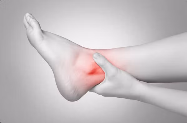 Sưng mắt cá chân và những điều bạn cần lưu ý