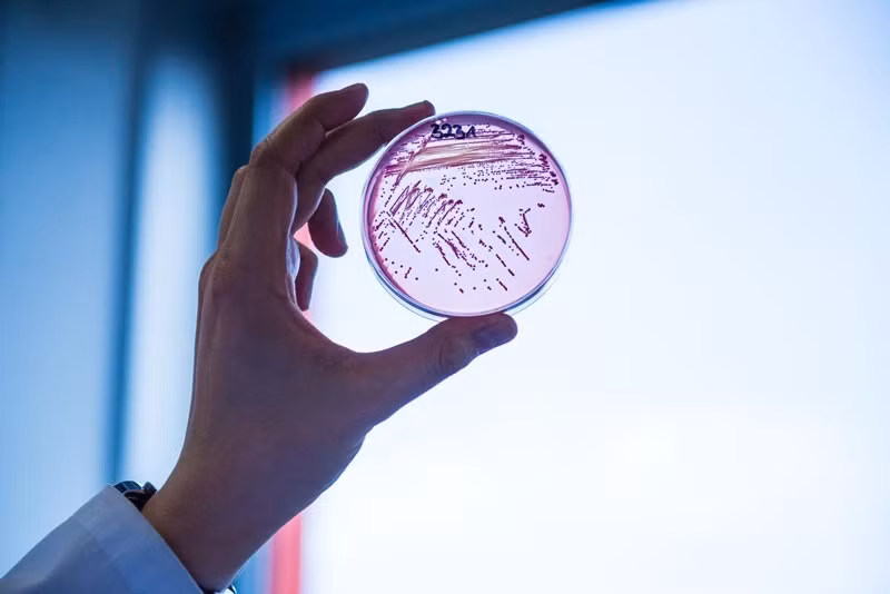 Một mẫu vi khuẩn E. coli. Ảnh: Đại học Giessen (Đức)