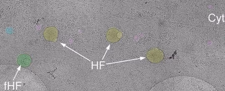 Việc phát hiện cấu trúc hemifusome có thể mở ra hướng nghiên cứu mới về nhiều bệnh lý phức tạp - Ảnh: AI