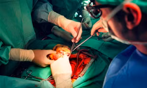 Người dân Thụy Sĩ được mặc định hiến tạng khi qua đời