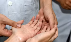 Giải pháp hỗ trợ điều trị giảm đổ mồ hôi tay hiệu quả