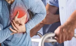 Đột quỵ có thể xảy ra ở người khỏe mạnh nếu bỏ qua dấu hiệu này