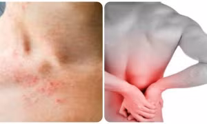Những triệu chứng suy thận nhẹ bạn cần biết