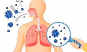 Bệnh nghề nghiệp thường âm thầm xuất hiện như thế nào?