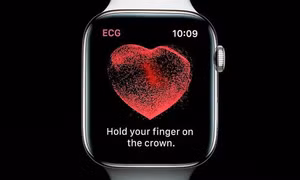 Apple Watch giúp phát hiện khối u