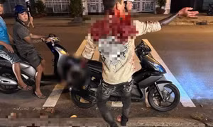 Chủ nợ chém con nợ đứt lìa bàn tay