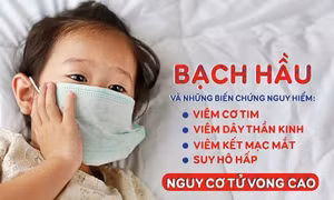 Thủ tướng yêu cầu chủ động kiểm soát, ngăn chặn, không để lây lan, bùng phát bệnh bạch hầu