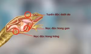 Ngộ độc do ăn thịt cóc và khuyến cáo từ chuyên gia