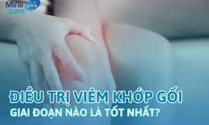Điều trị viêm khớp gối bằng tế bào gốc giai đoạn nào là tốt nhất